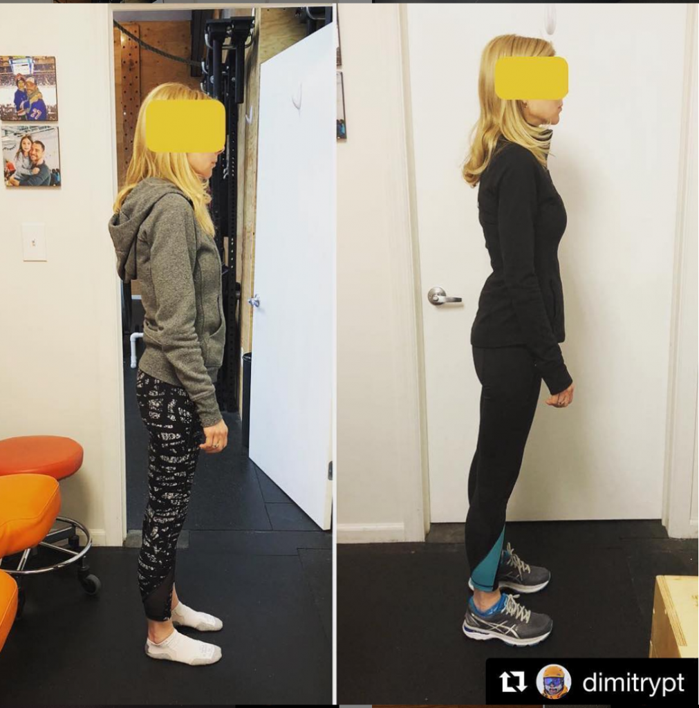 How You Stand Matters! - Total Physical Therapy